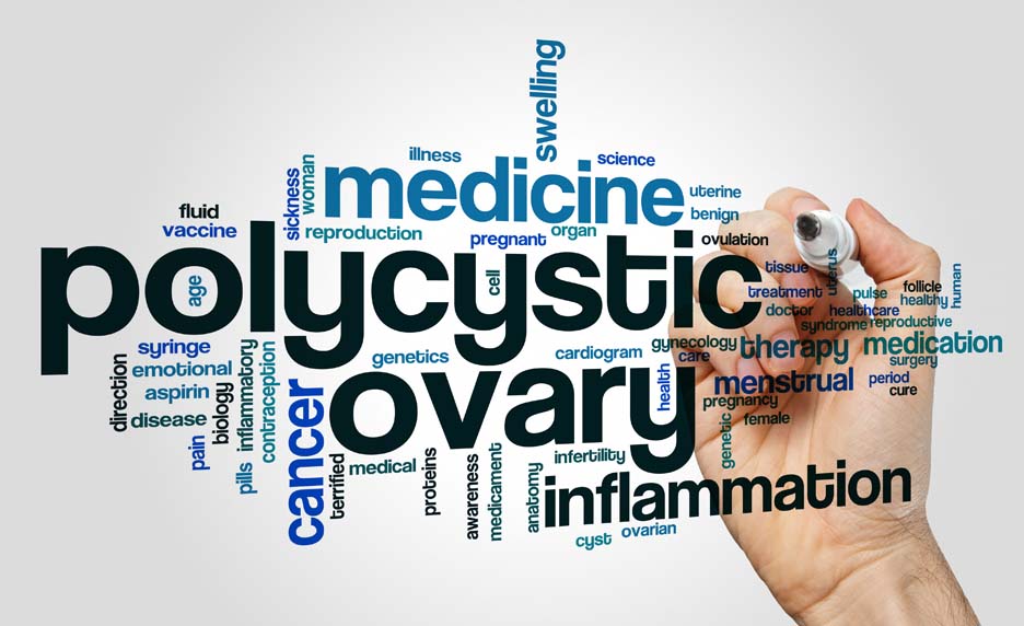 Syndrome des ovaires polykystiques : les TCA au cœur du cercle vicieux de la maladie